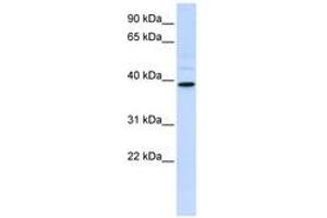 Image no. 1 for anti-Chitinase, Acidic (CHIA) (AA 108-157) antibody (ABIN6740778) (CHIA antibody  (AA 108-157))