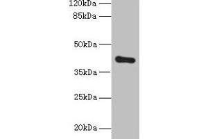 Western blot All lanes: ZDHHC4 antibody at 1. (ZDHHC4 antibody  (AA 277-344))