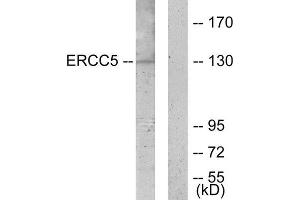 Western Blotting (WB) image for anti-DNA Repair Protein Complementing XP-G Cells (ERCC5) (N-Term) antibody (ABIN1849293) (ERCC5 antibody  (N-Term))