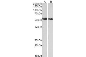 ABIN184685 (0. (Annexin A11 antibody  (N-Term))