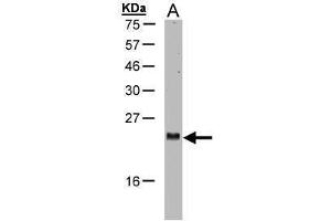 WB Image Sample(30 μg of whole cell lysate) A:H1299 15% SDS PAGE antibody diluted at 1:1000 (ARL2 antibody  (C-Term))