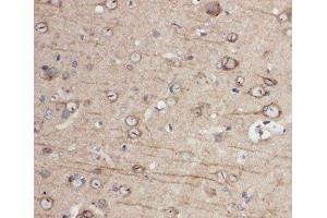 IHC-P: EphA1 antibody testing of rat brain tissue (EPHA1 antibody  (C-Term))