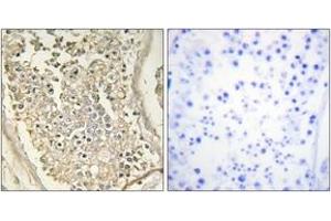 Immunohistochemistry (IHC) image for anti-ATPase, Cu++ Transporting, beta Polypeptide (ATP7B) (AA 161-210) antibody (ABIN1533712)
