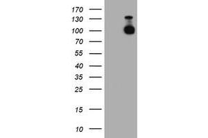 HEK293T cells were transfected with the pCMV6-ENTRY control (Left lane) or pCMV6-ENTRY CDH2 (Right lane) cDNA for 48 hrs and lysed. (N-Cadherin antibody)