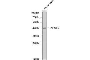 Western blot analysis of extracts of mouse brain, using TNF Antibody (ABIN6130740, ABIN6149294, ABIN6149295 and ABIN6222057) at 1:1000 dilution. (TNFAIP6 antibody  (AA 18-277))