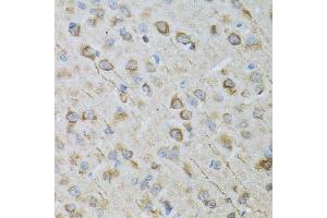 Immunohistochemistry of paraffin-embedded rat brain using CRYM antibody. (CRYM antibody  (AA 1-314))