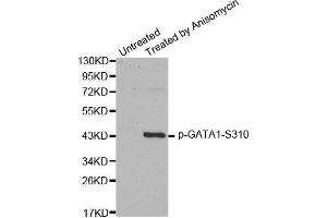 Western Blotting (WB) image for anti-GATA Binding Protein 1 (Globin Transcription Factor 1) (GATA1) (pSer310) antibody (ABIN1870204) (GATA1 antibody  (pSer310))