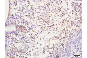 Formalin-fixed and paraffin embedded rat uterus tissue labeled with Anti-SHBG Polyclonal Antibody, Unconjugated at 1:200 followed by conjugation to the secondary antibody and DAB staining (SHBG antibody  (AA 301-402))