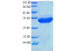 SDS-PAGE (SDS) image for Urate Oxidase (UOX) (AA 11-297) protein (His tag) (ABIN5713932) (Urate Oxidase Protein (UOX) (AA 11-297) (His tag))