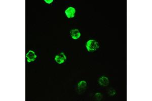 IHC analysis of Cyclophilin A using anti-Cyclophilin A antibody . (PPIA antibody  (AA 116-165))