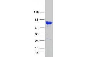 Western Blotting (WB) image for Carboxylesterase 1 (CES1) (Transcript Variant 2) protein (Myc-DYKDDDDK Tag) (ABIN2713928)
