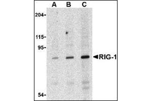 Western blot analysis of RIG-1 in C2C12 cell lysate with this product at (A) 0. (DDX58 antibody)