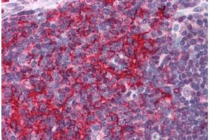 Human Thymus: Formalin-Fixed, Paraffin-Embedded (FFPE) (EFHD2 antibody  (N-Term))