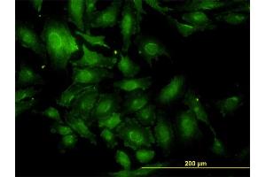 Immunofluorescence of monoclonal antibody to TSC22D1 on HeLa cell. (TSC22D1 antibody  (AA 1-144))