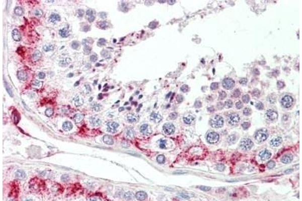 Lysozyme-Like 1 antibody  (N-Term)