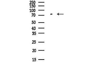 anti-Arginyl-tRNA Synthetase (RARS) antibody
