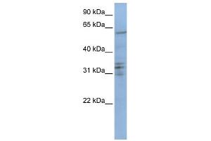 WB Suggested Anti-CENPB Antibody Titration: 0. (CENPB antibody  (C-Term))