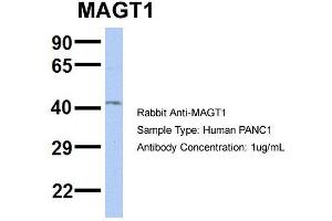 Host: Rabbit Target Name: MAGT1 Sample Type: PANC1 Antibody Dilution: 1.