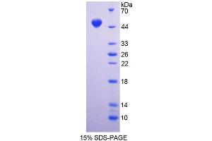 SDS-PAGE (SDS) image for Dystroglycan 1 (DAG1) (AA 28-406) protein (His tag) (ABIN4989259) (Dystroglycan Protein (AA 28-406) (His tag))
