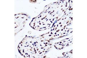 Immunohistochemistry of paraffin-embedded human placenta using OGT Rabbit pAb (ABIN3022707, ABIN3022708, ABIN3022709 and ABIN6219152) at dilution of 1:100 (40x lens).