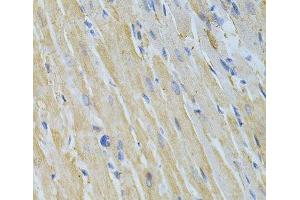 Immunohistochemistry of paraffin-embedded Rat heart using NME1 Polyclonal Antibody at dilution of 1:200 (40x lens).