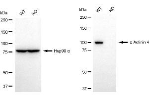Western blotting analysis using alpha actinin 4 antibody (ABIN7797475).
