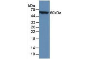 Detection of Recombinant CALB, Mouse using Polyclonal Antibody to Calbindin (CALB) (CALB1 antibody  (AA 3-261))