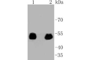 Lane 1: 293 lysates, Lane 2: F9 lysates probed with p53(S392) (3A1) Monoclonal Antibody  at 1:1000 overnight at 4˚C. (p53 antibody  (pSer392))