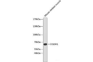 Western blot analysis of extracts of Mouse skeletal muscle using COL9A1 Polyclonal Antibody at dilution of 1:1000.