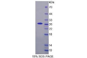Image no. 1 for X-Linked Inhibitor of Apoptosis (XIAP) (AA 8-219) protein (His tag) (ABIN6238563)
