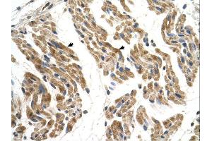 SLC35F2 antibody was used for immunohistochemistry at a concentration of 4-8 ug/ml. (SLC35F2 antibody  (N-Term))