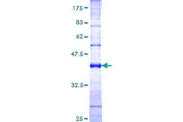 HECTD1 Protein (AA 3-110) (GST tag)