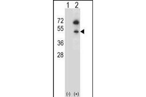 Western blot analysis of GNAS (arrow) using rabbit polyclonal GNAS Antibody (C-term) (ABIN656989 and ABIN2850497). (GNAS antibody  (C-Term))