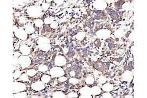 IHC analysis of FKBP135/FKBP15 using anti-FKBP135/FKBP15 antibody (ABIN7600397). (FKBP15 antibody  (AA 19-1210))