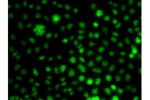 Immunofluorescence analysis of A549 cells using UBE2R2 antibody (ABIN5975512). (UBE2R2 antibody)