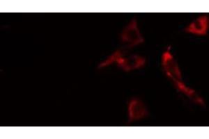 ABIN6267457 staining 293 cells by IF/ICC. (SHC1 antibody  (pTyr427))