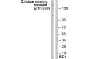Western blot analysis of extracts from LOVO cells, using Calcium Sensing Receptor (Phospho-Thr888) Antibody. (CASR antibody  (pThr888))