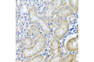 Immunohistochemistry of paraffin-embedded mouse kidney using HD antibody (ABIN3022456, ABIN3022457, ABIN3022458 and ABIN6218830) at dilution of 1:100 (40x lens). (HDAC6 antibody  (AA 1-200))
