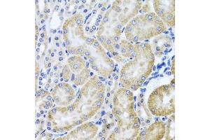 Immunohistochemistry of paraffin-embedded mouse kidney using HD antibody (ABIN3022456, ABIN3022457, ABIN3022458 and ABIN6218830) at dilution of 1:100 (40x lens). (HDAC6 antibody  (AA 1-200))