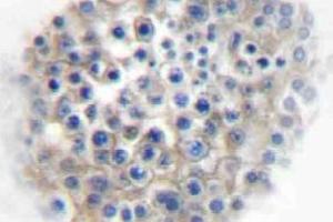 Immunohistochemistry (IHC) analyzes of AR alpha2A antibody in paraffin-embedded human testis tissue. (ADRA2A antibody)