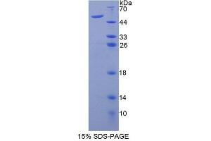 SDS-PAGE analysis of Mouse AUP1 Protein.