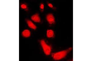 Immunofluorescent analysis of PKA C alpha/beta/gamma staining in HEK293T cells. (PKA C alpha/beta/gamma (Center) antibody)