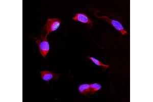 IF analysis of DDAH2 using anti-DDAH2 antibody (ABIN4886561). (DDAH2 antibody  (C-Term))