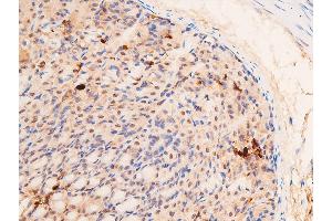 Immunohistochemistry (IHC) image for anti-Tumor Protein P53 (TP53) (acLys319) antibody (ABIN6254862)