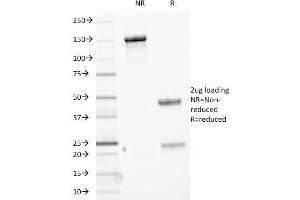 SDS-PAGE Analysis Purified Cytokeratin, HMW MAb (KRTH/1076). (Cytokeratin 2 antibody)