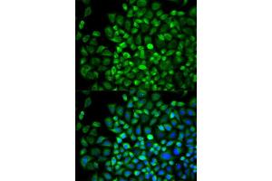 Immunofluorescence analysis of A549 cell using ANGPTL4 antibody. (ANGPTL4 antibody  (AA 26-406))