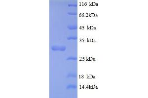 SDS-PAGE (SDS) image for Tryptase alpha/beta 1 (TPSAB1) (AA 35-267), (partial) protein (His tag) (ABIN5710538)