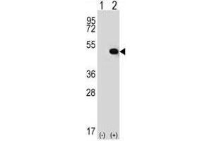 Western blot analysis of TRIP13 (arrow) using rabbit polyclonal TRIP13 Antibody (C-term) . (TRIP13 antibody  (C-Term))