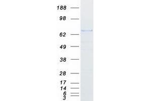 Validation with Western Blot