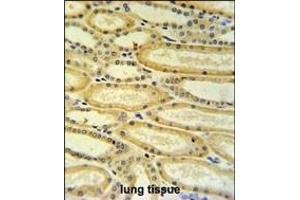 HSD17B11 Antibody (N-term) (ABIN653756 and ABIN2843056) IHC analysis in formalin fixed and paraffin embedded lung tissue followed by peroxidase conjugation of the secondary antibody and DAB staining. (HSD17B11 antibody  (N-Term))